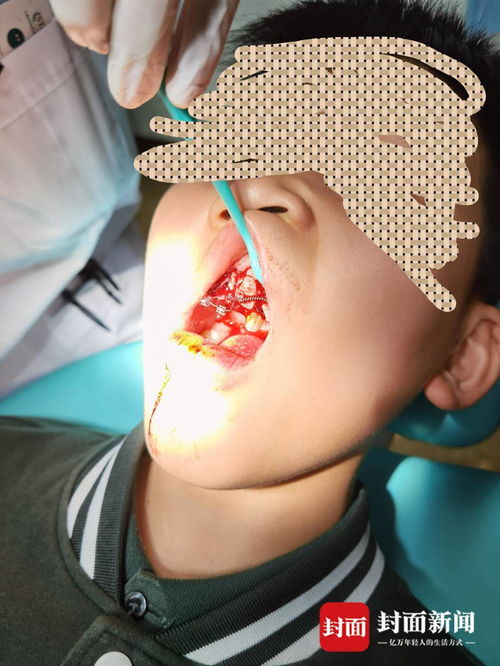 重慶特斯拉車主遭遇驚魂一幕 停車時車輛自動加速撞墻，致孩子受傷